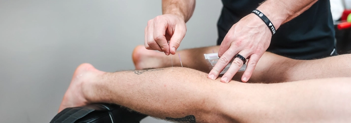 Chiropractic Mayfield Heights OH Dry Needling HERO A patient receiving dry needling on their leg.